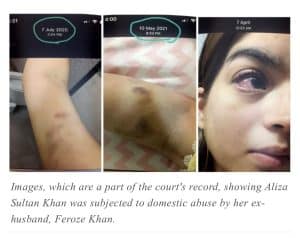 Syeda Aliza bruises