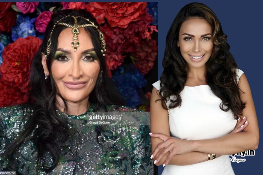 hamida sozahdah plastic surgery Image 4
