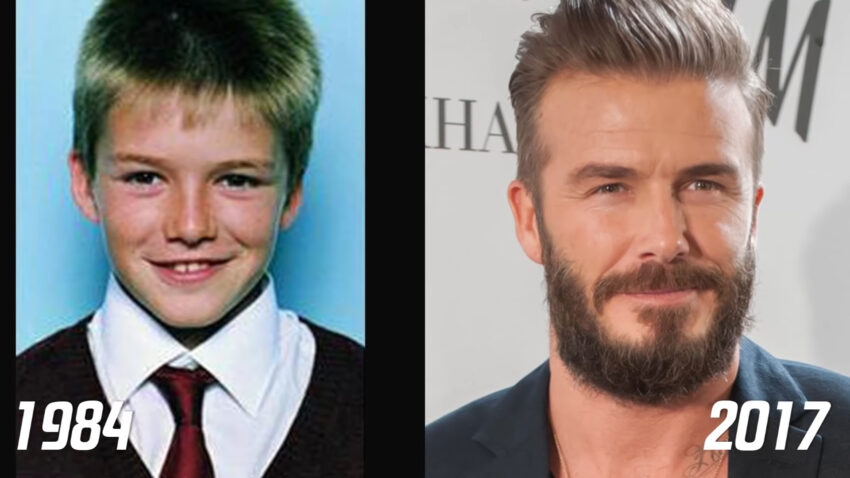 David Beckham - Teeth then and now